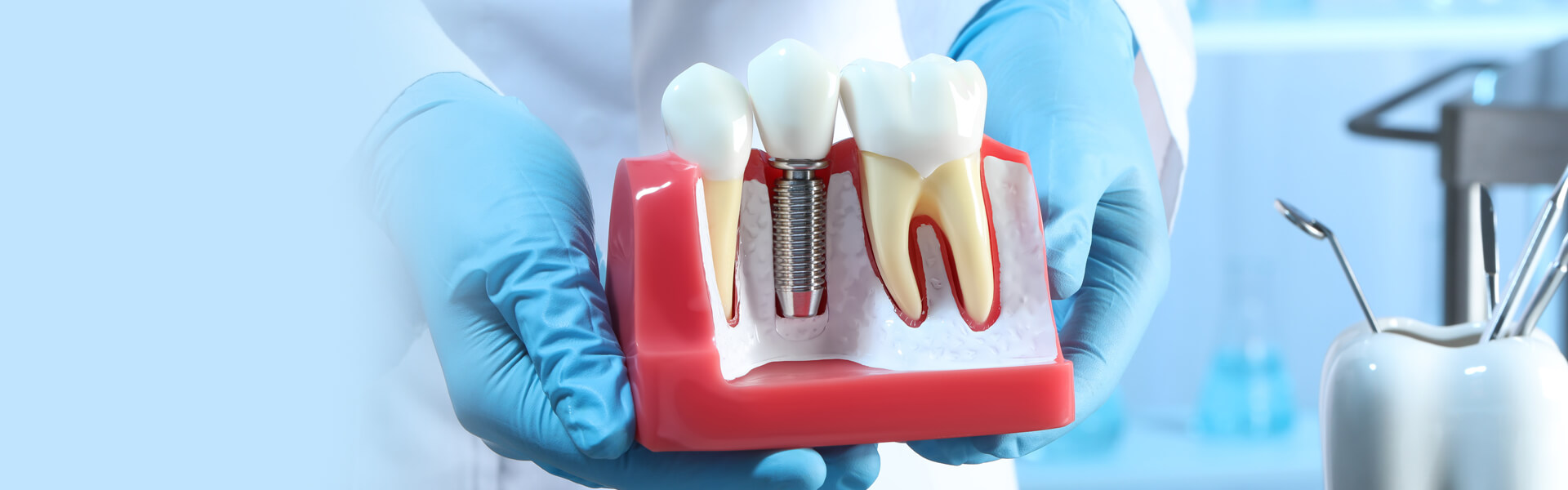 Why Does Your Face Swell After Getting Dental Implants?